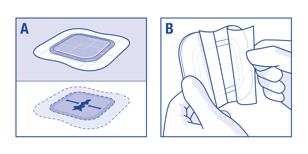 Two images to visualize how to apply Cutimed Sorbion Border Sacrum.  Two images to visualize how to apply Cutimed Sorbion Border Sacrum.